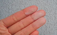 チョーキング(白い粉)の症状例